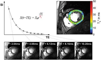 Myocardial T2* Mapping with Ultrahigh Field Magnetic Resonance: Physics and Frontier Applications